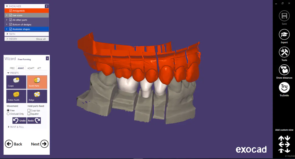 HỆ THỐNG THIẾT KẾ PHỤ HÌNH ẢO TRÊN MÁY TÍNH BẰNG CÔNG NGHỆ 3D HIỆN ĐẠI